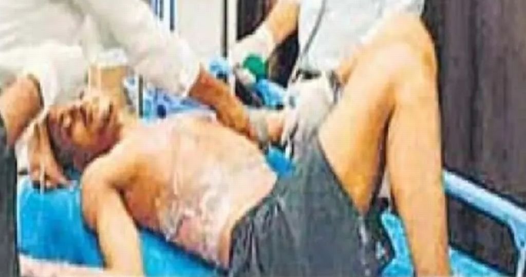 पत्नी से चल रहा था विवाद....बेटा घर आया तो पिता ने पेट्रोल छिड़ककर लगा दी आग