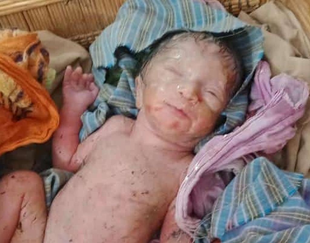 हाथ-पैर हिलते दिखे तो बच गई जान...मरा बताकर कूड़ेदान में डाल दिया था नवजात