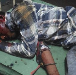 बाइक से भाग रहा था प्रेमी युगल... अधेड़ से टक्कर हुई तो डेढ़ सौ मीटर तक घसीट ले गया