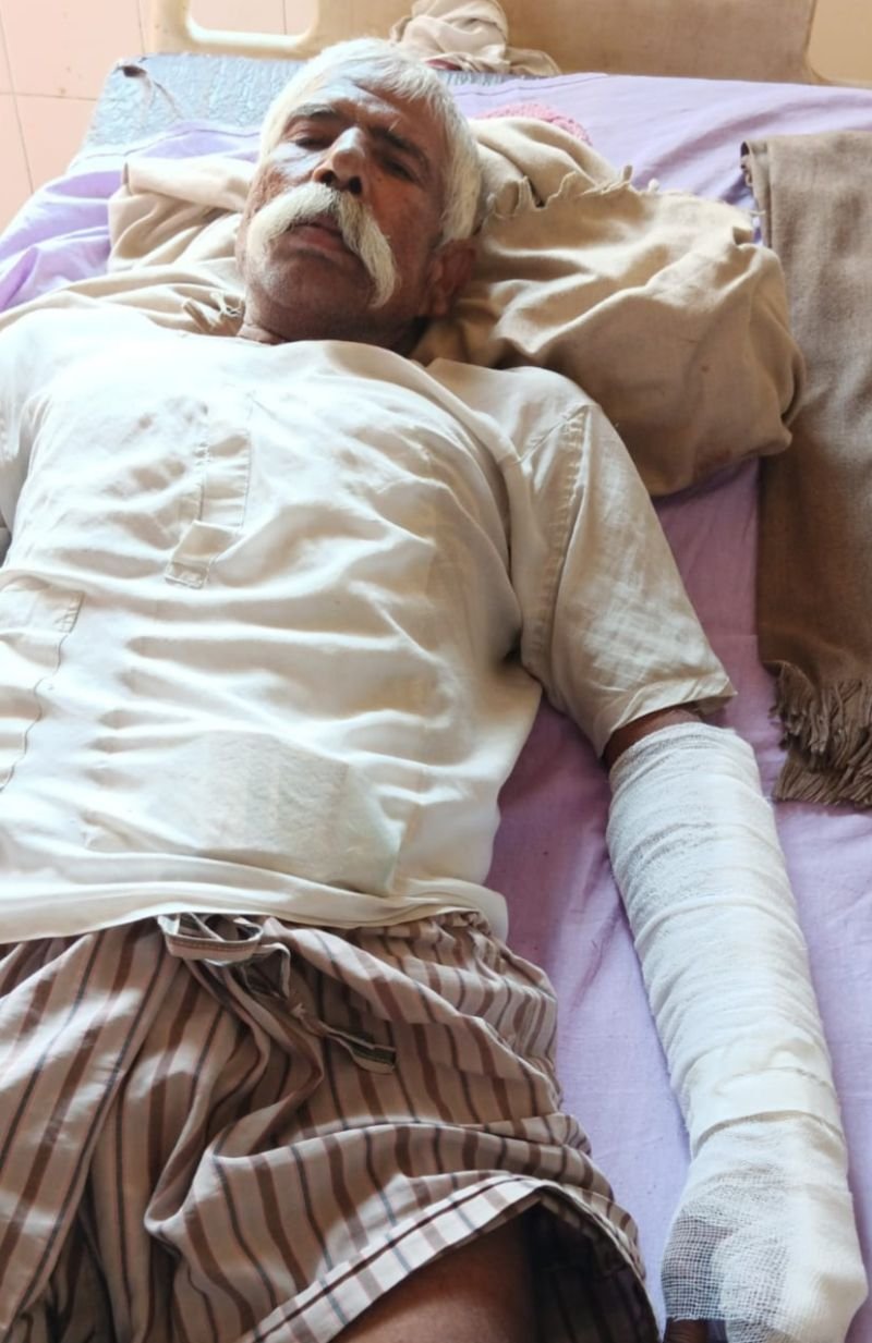 दिवाली पर हुई गाली गलौज....सोते समय पिटाई कर हाथ पैर तोड़ डाले