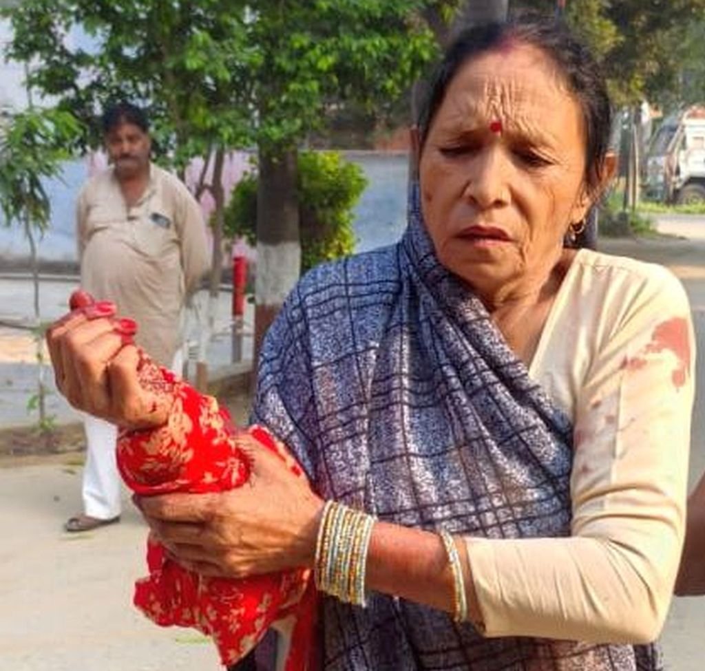 गाली देने से मना किया तो घर में घुसा सिरफिरा, फरसा लेकर ताबड़तोड़ कर दिए वार