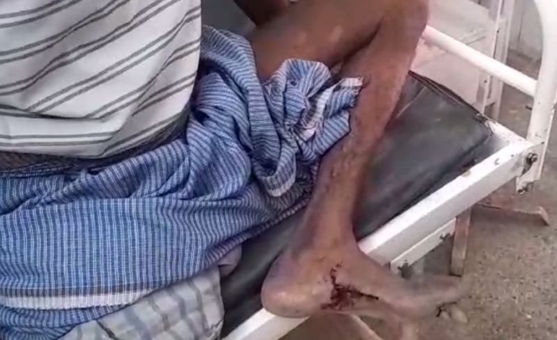 इस गांव में मचा भेड़िये का शोर....निकला सियार, बच्चे समेत तीन को काटकर किया जख्मी