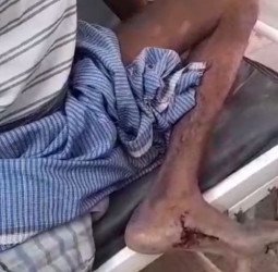 इस गांव में मचा भेड़िये का शोर....निकला सियार, बच्चे समेत तीन को काटकर किया जख्मी