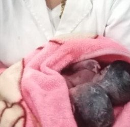 गर्भ में ही सड़ गए जुडवां बच्चे...प्रसव हुआ तो निकली लाशें, जानिये कहां का है मामला